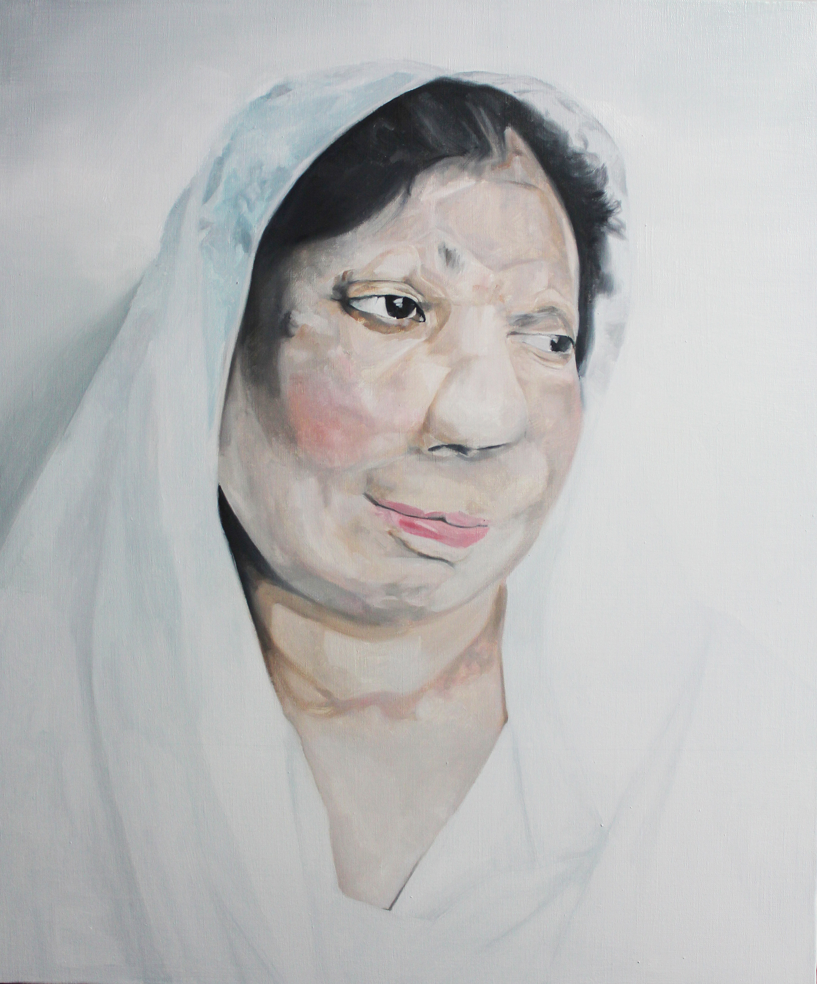 Acid Attack Victim (3)